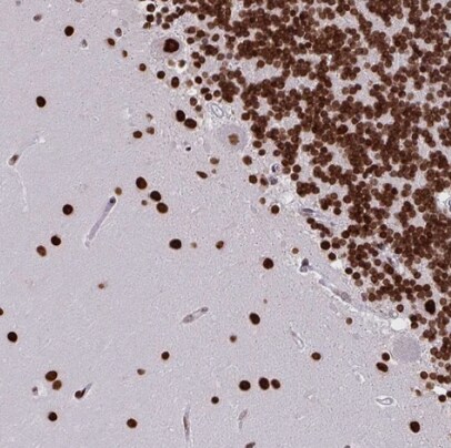 CLP1/HEAB Antibody - BSA Free