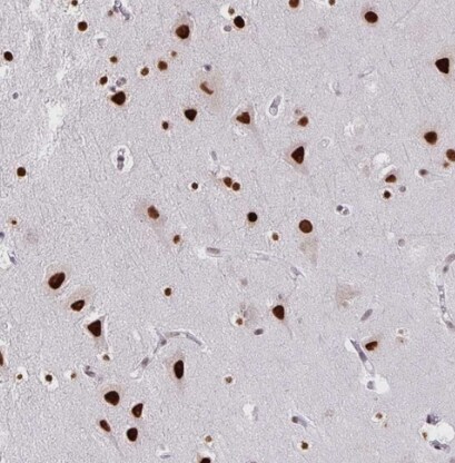 CLP1/HEAB Antibody - BSA Free
