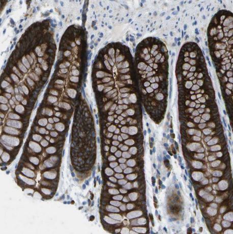 WNK2 Antibody