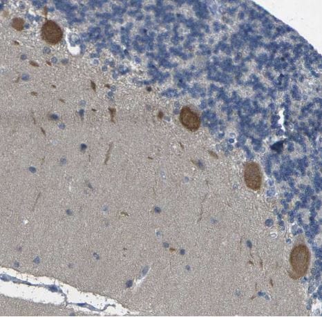 WNK2 Antibody
