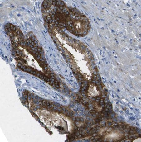 WNK2 Antibody