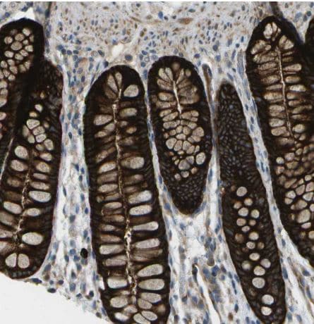 WNK2 Antibody