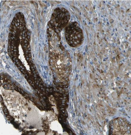 WNK2 Antibody