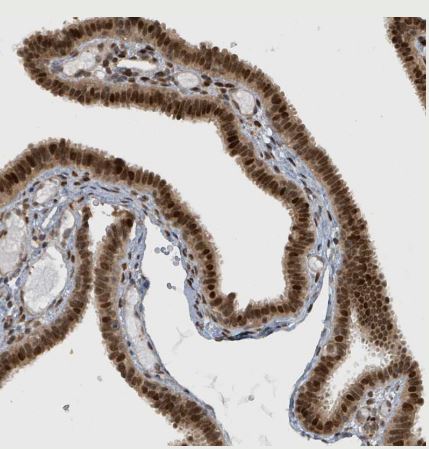 PHIP Antibody