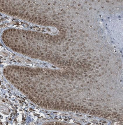 PHIP Antibody