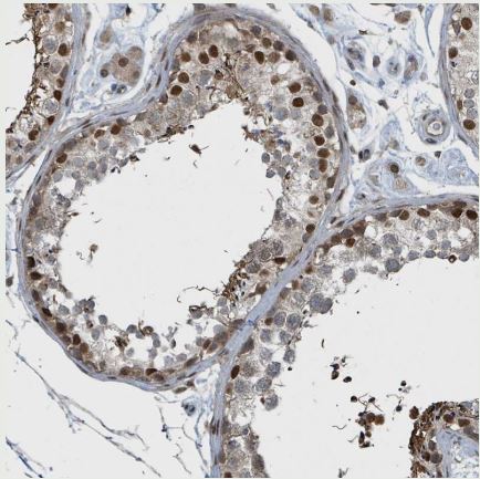 PHIP Antibody