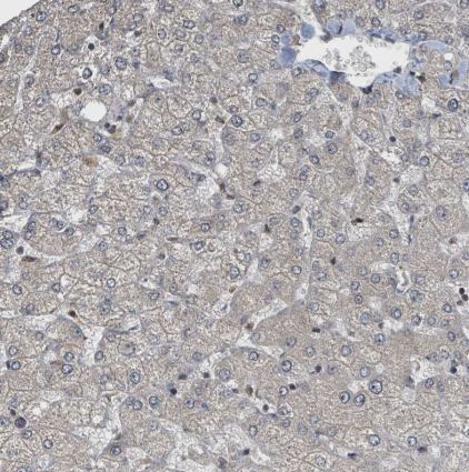 PHIP Antibody