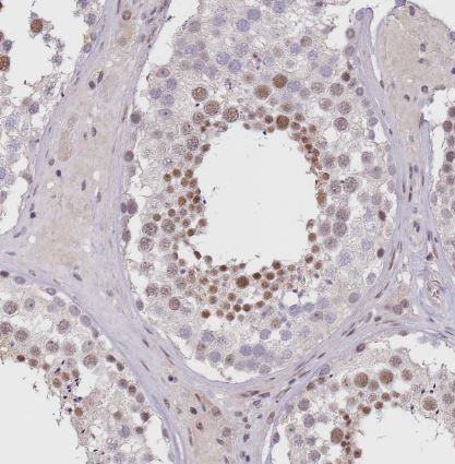 CIZ1 Antibody
