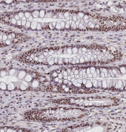 CIZ1 Antibody