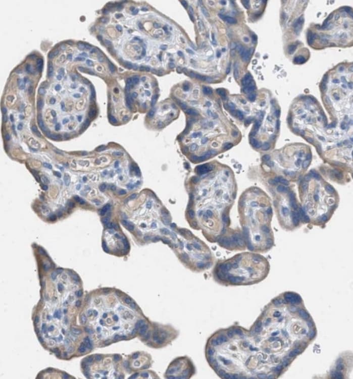 Acyloxyacyl Hydrolase Antibody - BSA Free