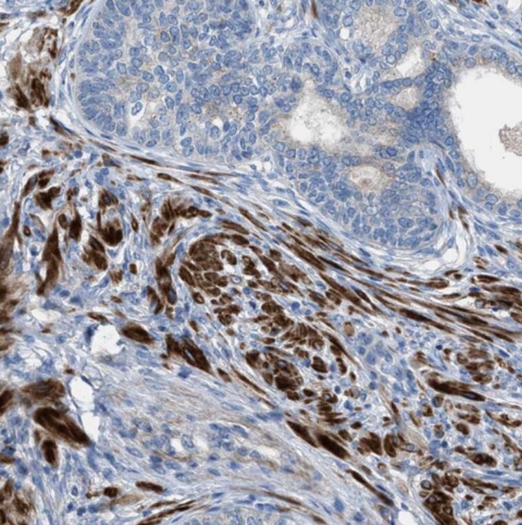 Acyloxyacyl Hydrolase Antibody - BSA Free