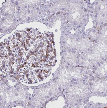 PITPNM3 Antibody