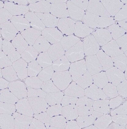 PITPNM3 Antibody