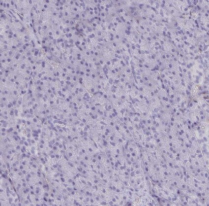 PITPNM3 Antibody