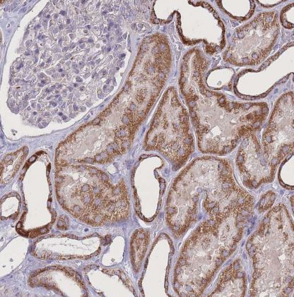 Pyruvate Dehydrogenase E1-alpha subunit Antibody