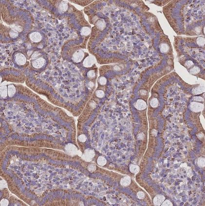 Pyruvate Dehydrogenase E1-alpha subunit Antibody