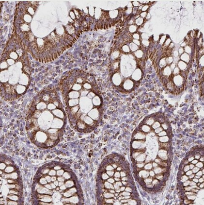 Pyruvate Dehydrogenase E2 Antibody - BSA Free