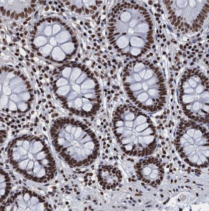 SAE2 Antibody