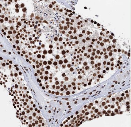 SAE2 Antibody