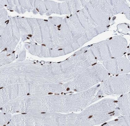 SAE2 Antibody