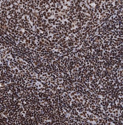 SAE2 Antibody