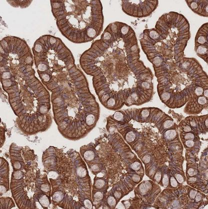 PLD1 Antibody
