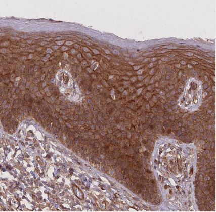 PLD1 Antibody
