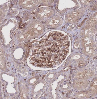 PLD1 Antibody