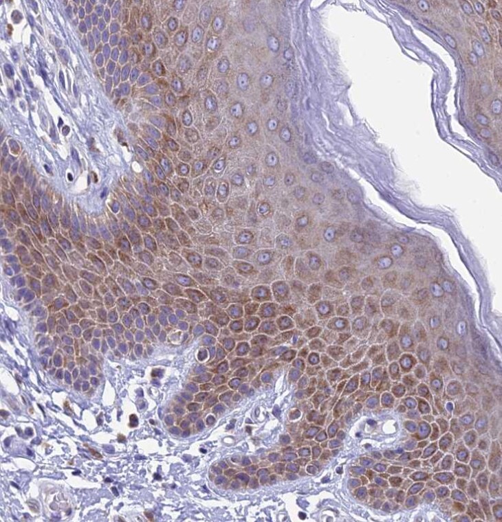 REEP4 Antibody - BSA Free