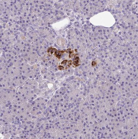 S100A7L2 Antibody