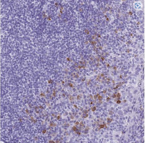 Bestrophin 4 Antibody