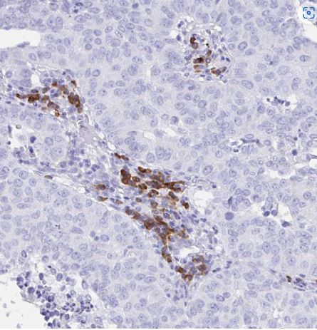 Bestrophin 4 Antibody