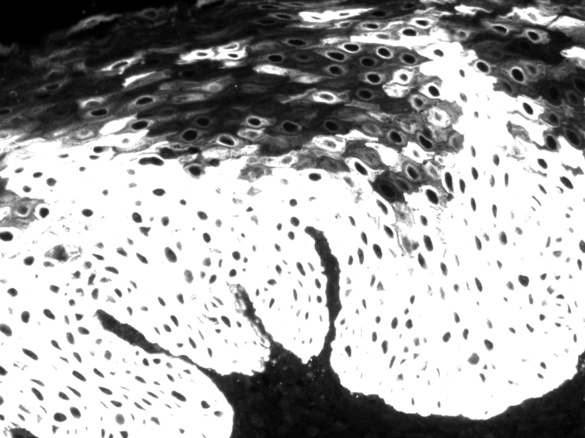Cytokeratin 14 Antibody (SPM263) - Azide and BSA Free