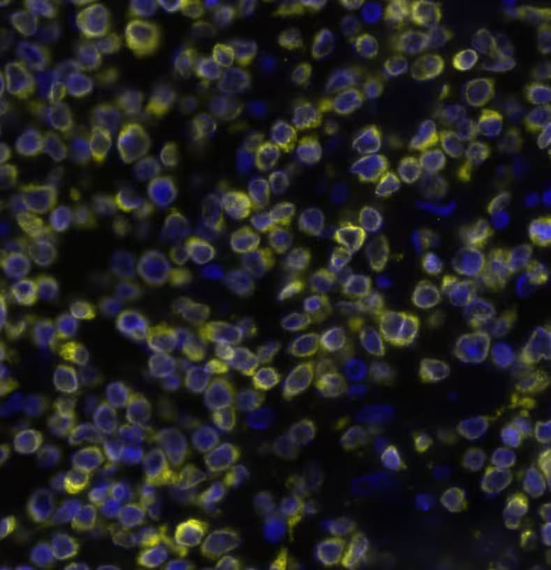 Bcl-2 Antibody (124) Detection of BCL2 in Human Non-Hodgkin’s Lymphoma via seqIF™ staining on COMET™