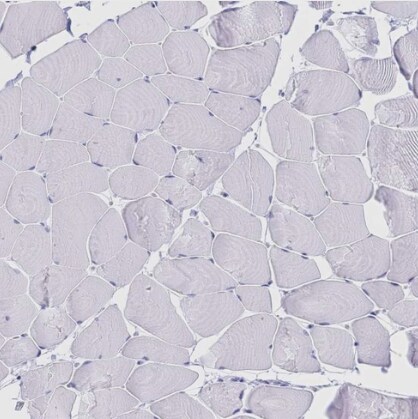 Meprin beta Subunit/MEP1B Antibody - BSA Free