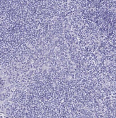 Meprin beta Subunit/MEP1B Antibody - BSA Free