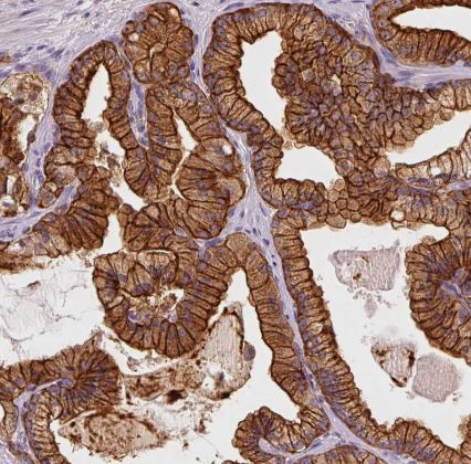IQGAP2 Antibody
