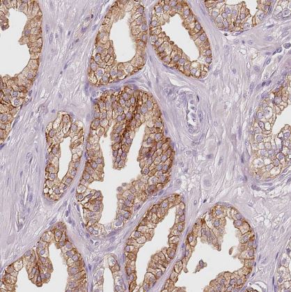 IQGAP2 Antibody