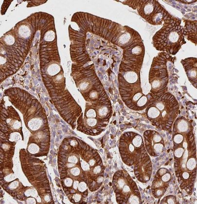 IQGAP2 Antibody