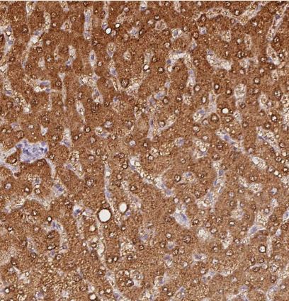 IQGAP2 Antibody