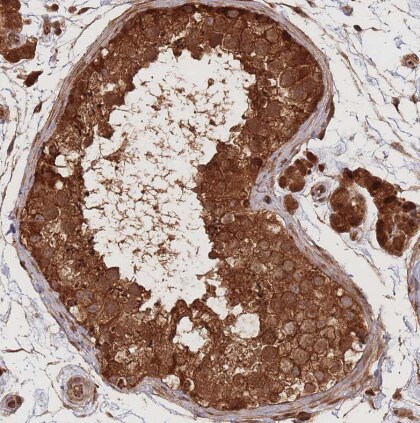 Endoglycan/PODXL2 Antibody