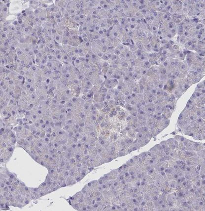 CRACC/SLAMF7 Antibody