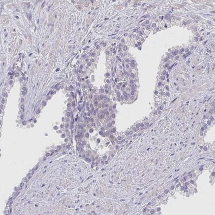 CRACC/SLAMF7 Antibody