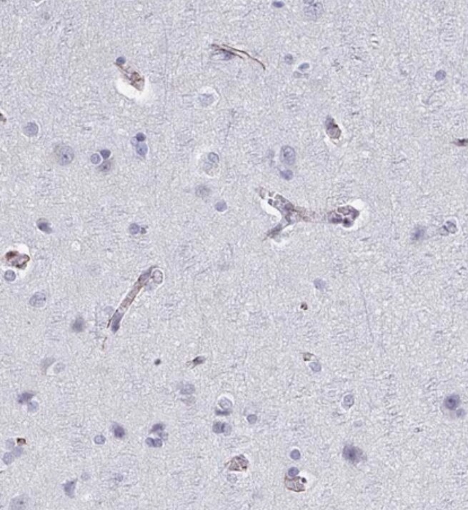 TMEM92 Antibody - BSA Free