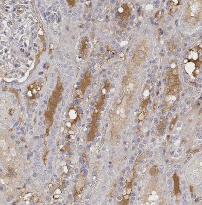 IGFBP-4 Antibody