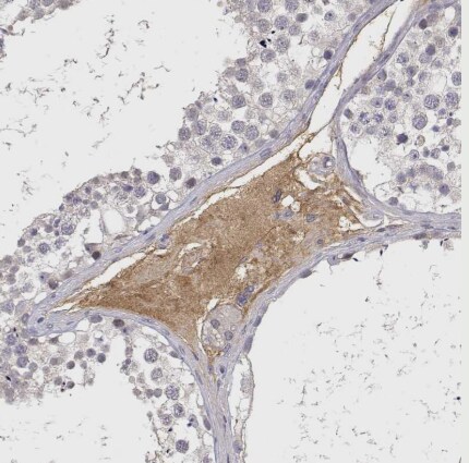 IGFBP-4 Antibody