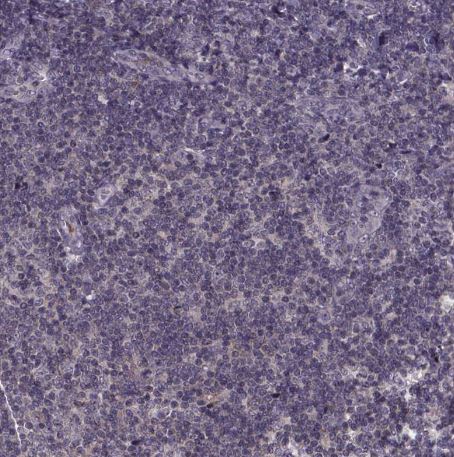 SMIM1 Antibody