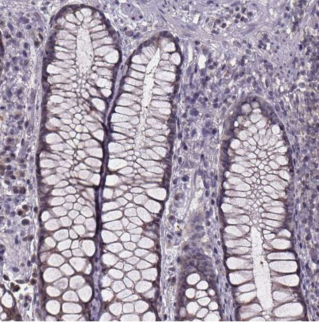 SMIM1 Antibody
