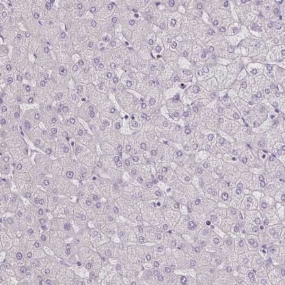 BEND2 Antibody