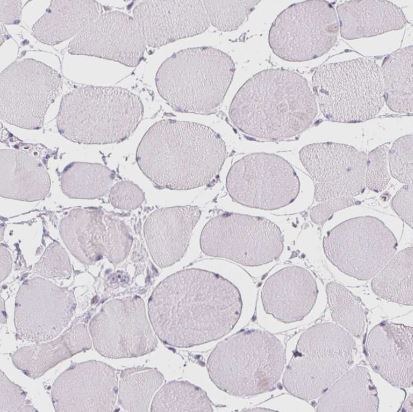 BEND2 Antibody